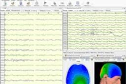 ЭЭГ Нейрон-Спектр электроэнцефалограф для профосмотров