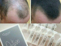 Сыворотка для роста волос Occuba Professional